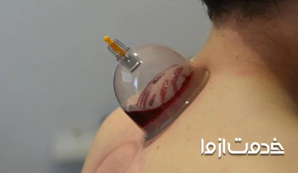 قیمت حجامت	