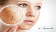 علت خشکی پوست