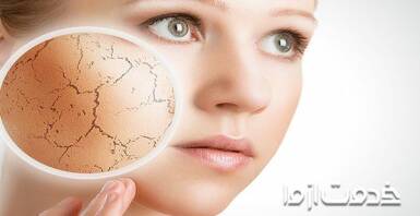 علت خشکی پوست