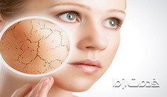 علت خشکی پوست