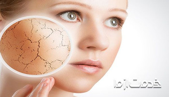 علت خشکی پوست