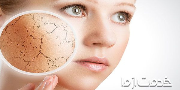 علت خشکی پوست