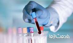 چگونه جواب آزمایش خون را بخوانیم؟