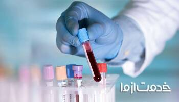 چگونه جواب آزمایش خون را بخوانیم؟