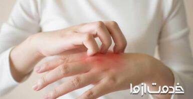 علت بیماری قارچ پوستی 