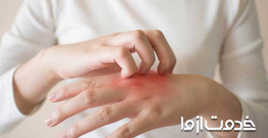 علت بیماری قارچ پوستی 