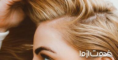 علت نازک شدن موی سر