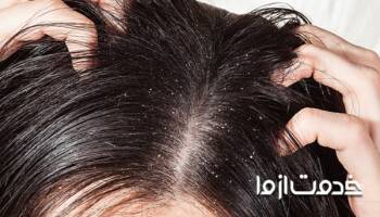  شپش موی سر و بهترین روش درمان آن