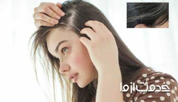روش‌های سیاه کردن مو سفید