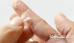 آسان‌ترین روش پاک کردن چسب قطره ای روی دست