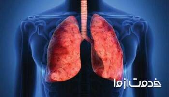 راهکارهای تقویت ریه با ورزش