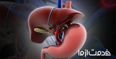 بهترین روش درمان کبد چرب گرید 1، 2 و3 در خانه