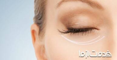 انواع کرم آبرسان دور چشم و ویژگی‌های آن