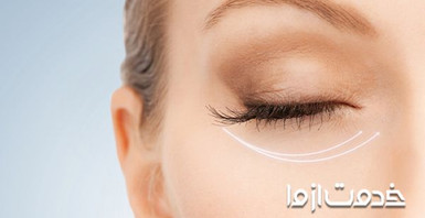 انواع کرم آبرسان دور چشم و ویژگی‌های آن