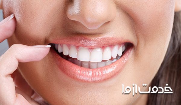 سفید کردن دندان با روش‌های خانگی و موثر