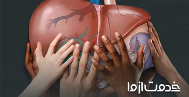 کبد چرب و انواع آن (گرید 1، 2 و 3)