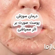 درمان سوزش پوست صورت بر اثر سمپاشی