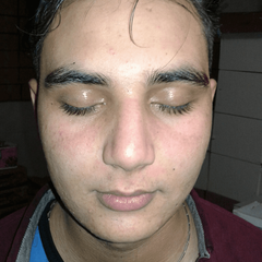 resume image