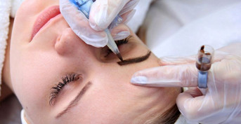 mobile head section image