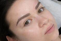 میکروبلیدینگ و میکروپیگمنتیشن بانوان