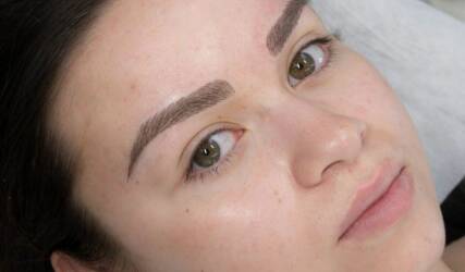 میکروبلیدینگ و میکروپیگمنتیشن