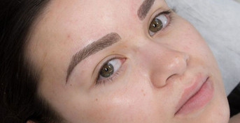 mobile head section image