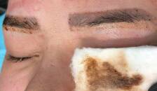 پاک کردن تاتو ابرو بانوان