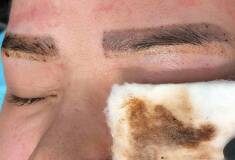 پاک کردن تاتو ابرو بانوان