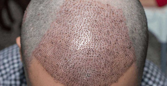 mobile head section image