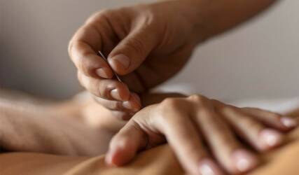 طب سوزنی در منزل