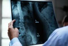 رادیولوژی در منزل