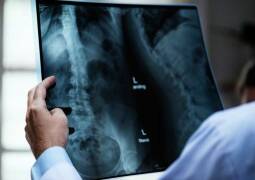 رادیولوژی در منزل