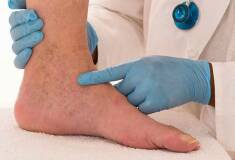 رفع ضایعات عروقی پوست