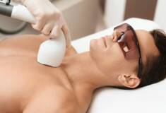 لیزر موهای زائد