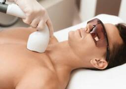 لیزر موهای زائد