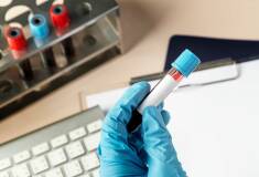 آزمایش تست اعتیاد