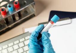 آزمایش تست اعتیاد