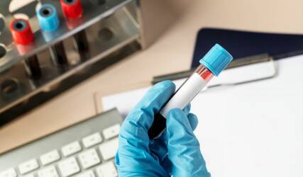 آزمایش تست اعتیاد