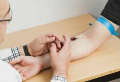 آزمایش ایدز و هپاتیت