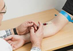 آزمایش ایدز و هپاتیت