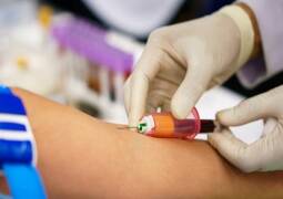 نمونه گیری در منزل