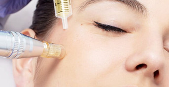 mobile head section image